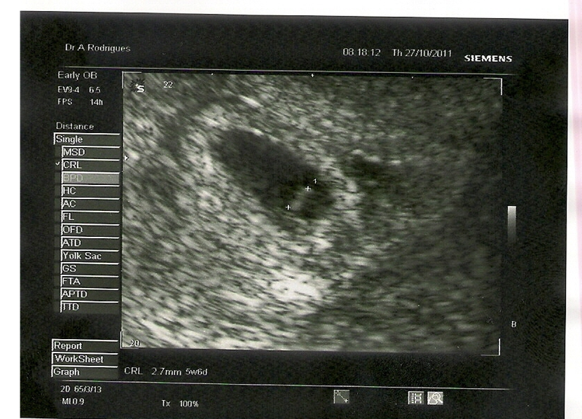 My First Scan 5w6d