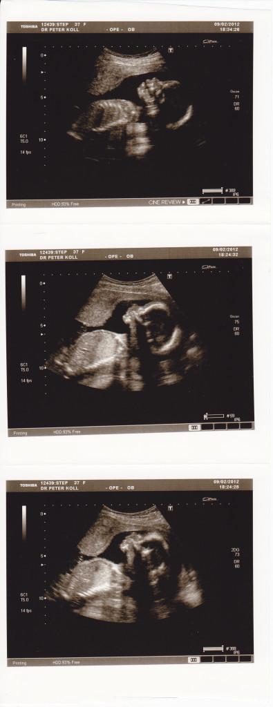 wk20d6scAN